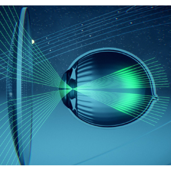 Очковая линза Stellest (Essilor) для замедления прогрессирования миопии у детей